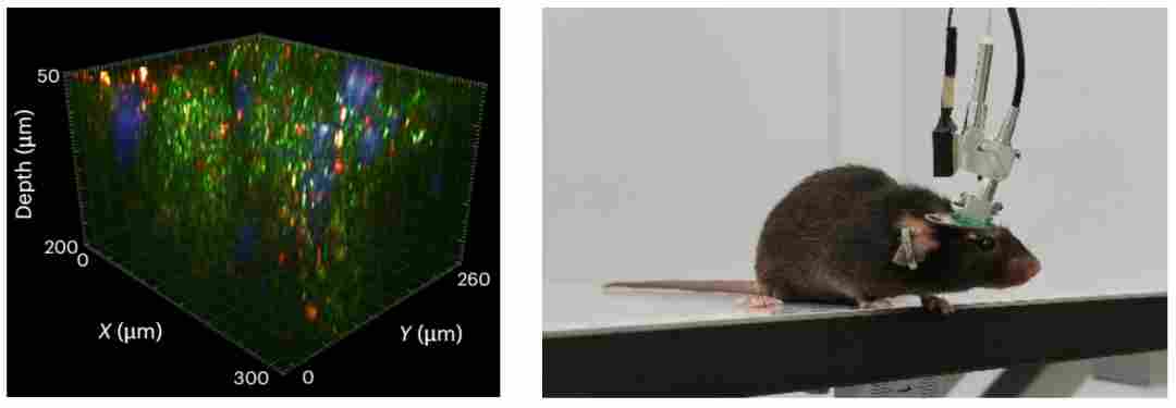 超维景完成超亿元 B+轮融资，开启「高端科学仪器+脑机」战略新篇(图3)
